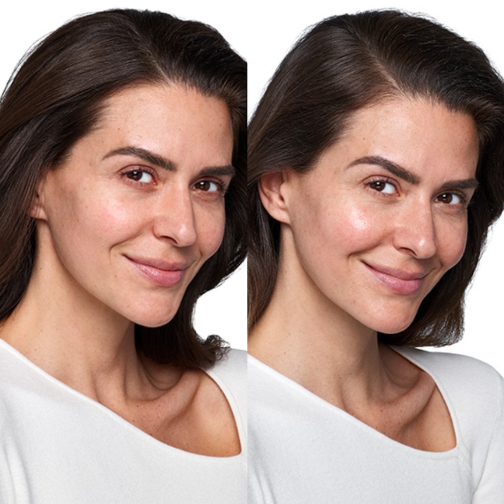 Before and After 3