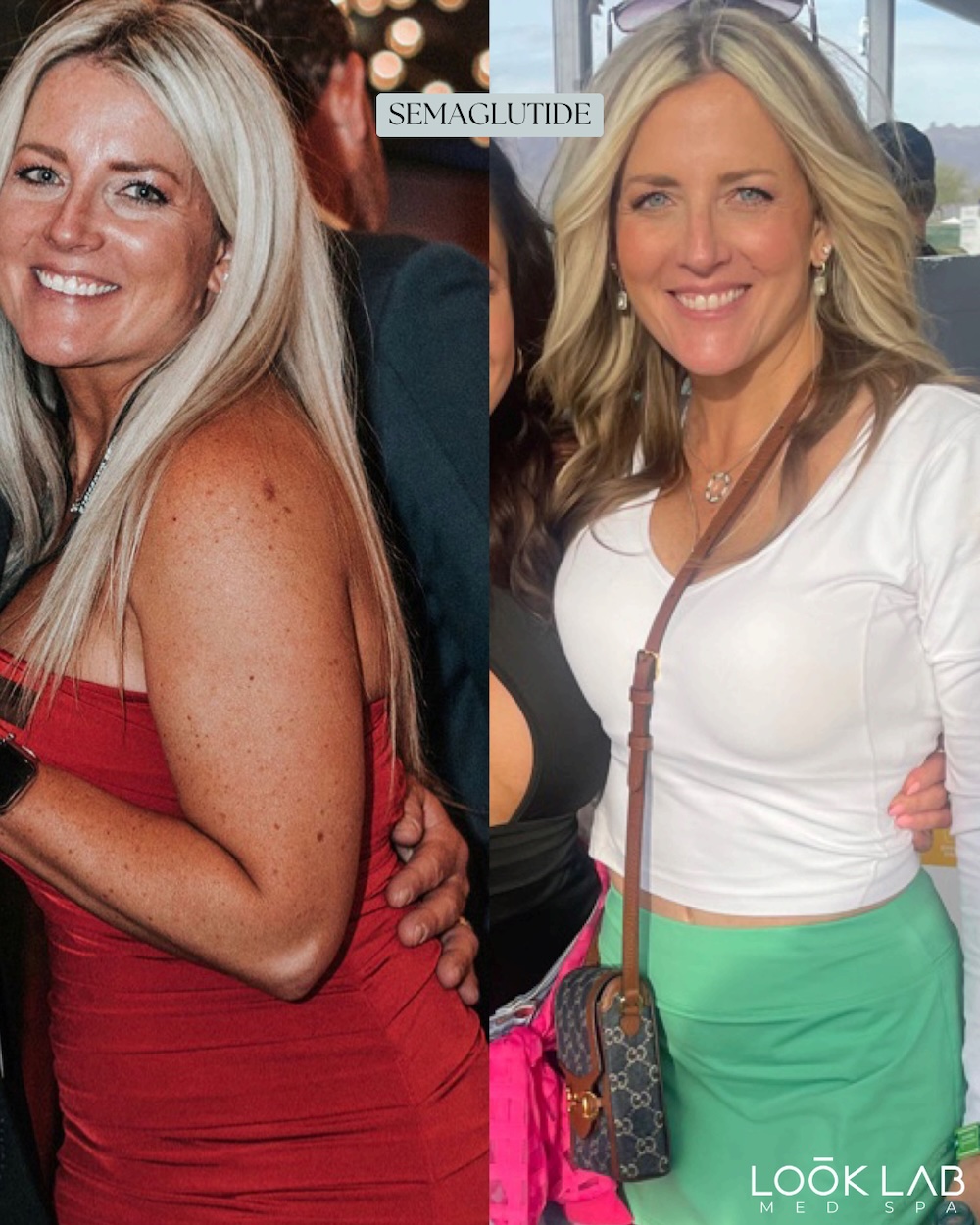Before and After 1