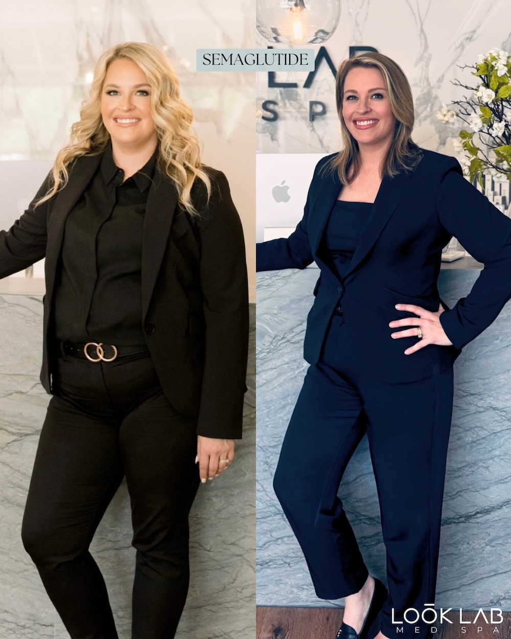 Before and After 2