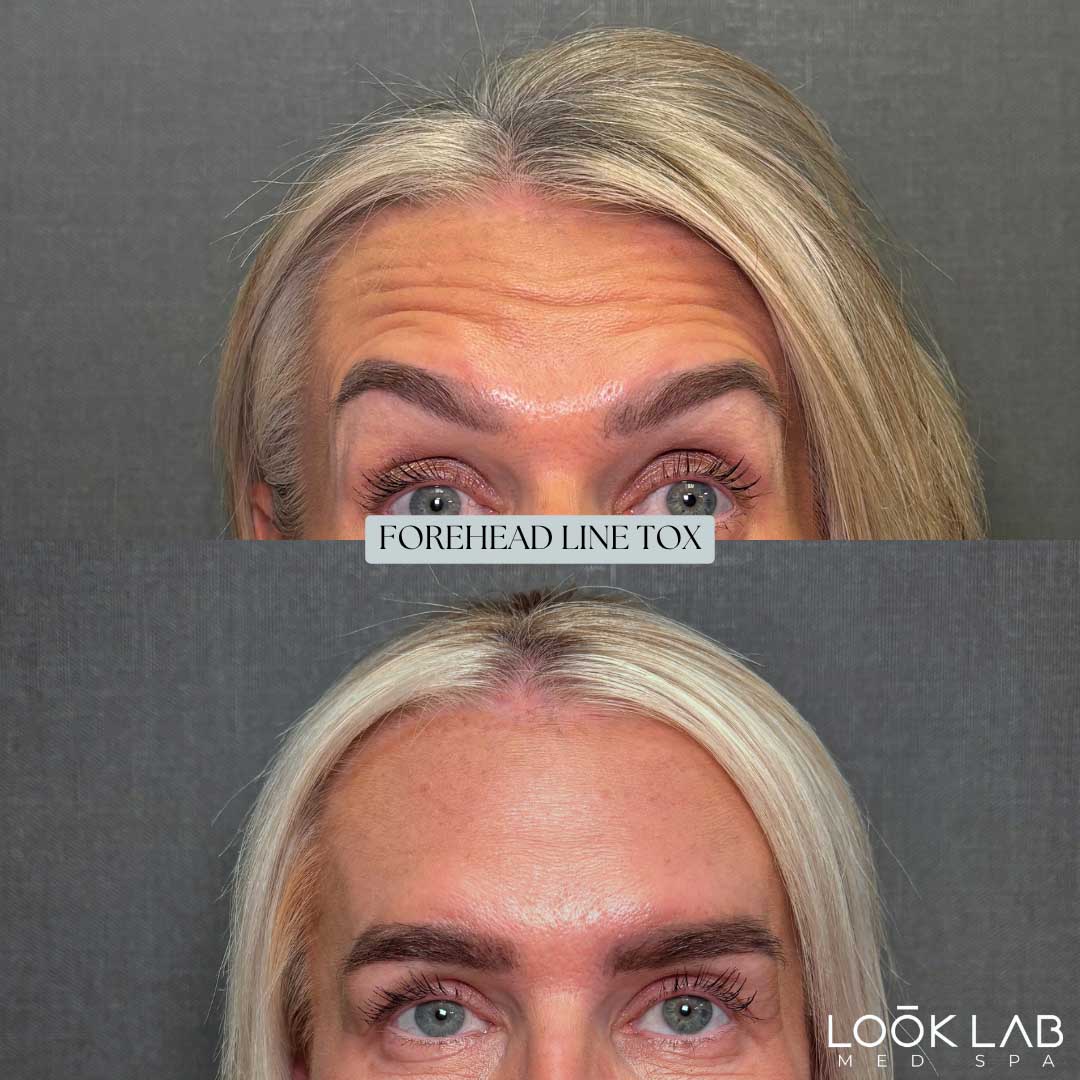 Before and After 17