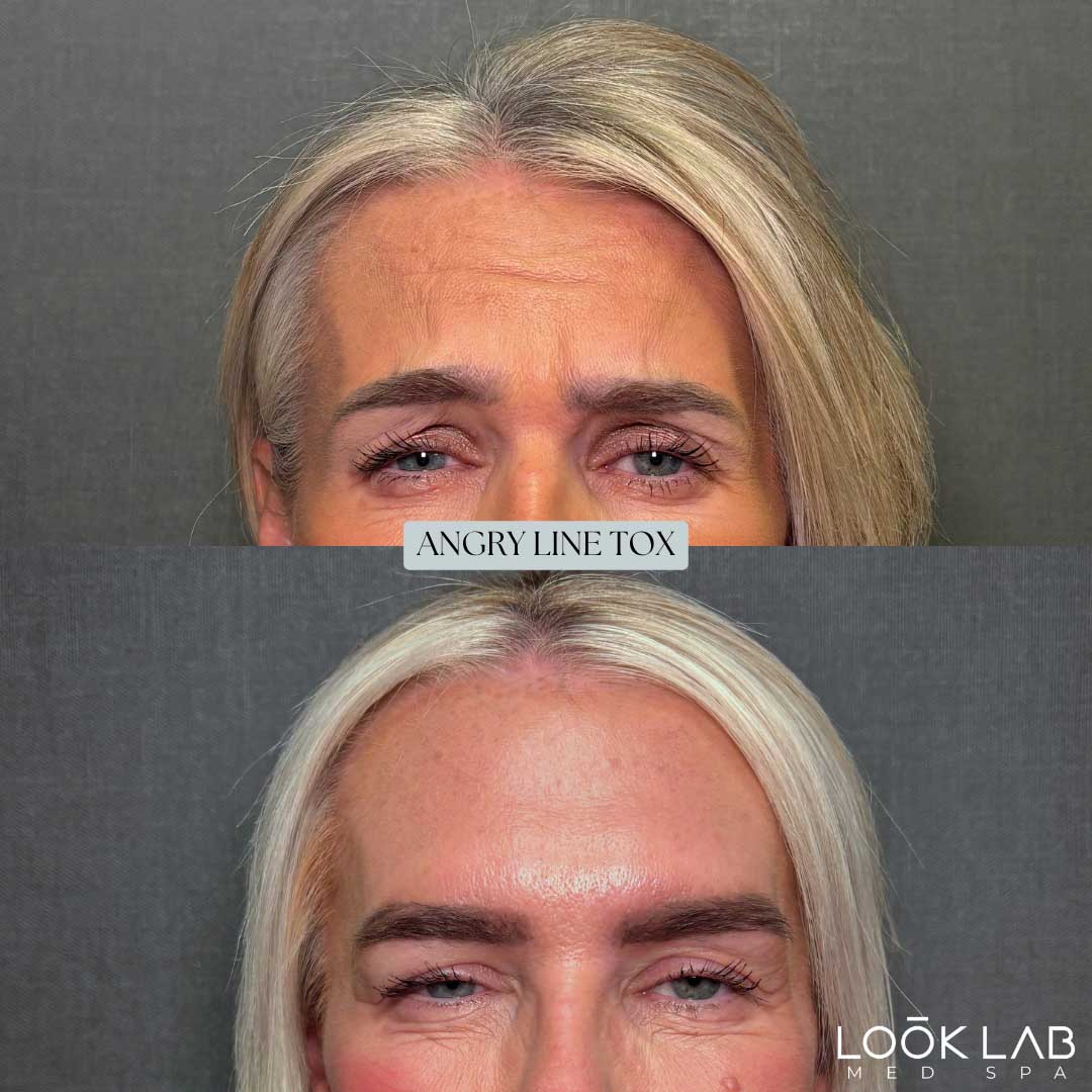 Before and After 18