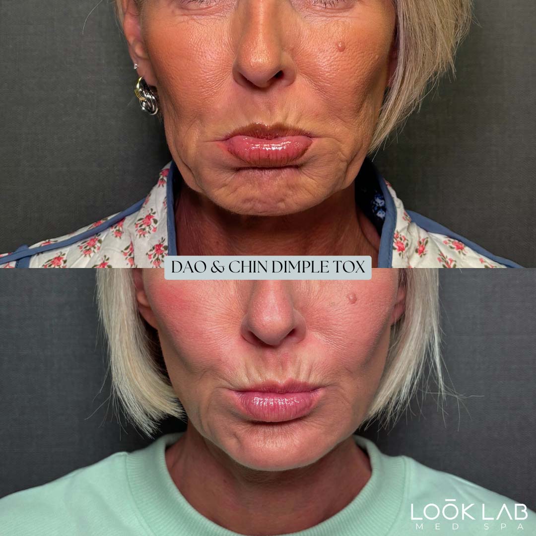 Before and After 19