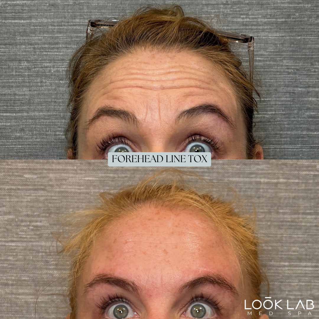 Before and After 24