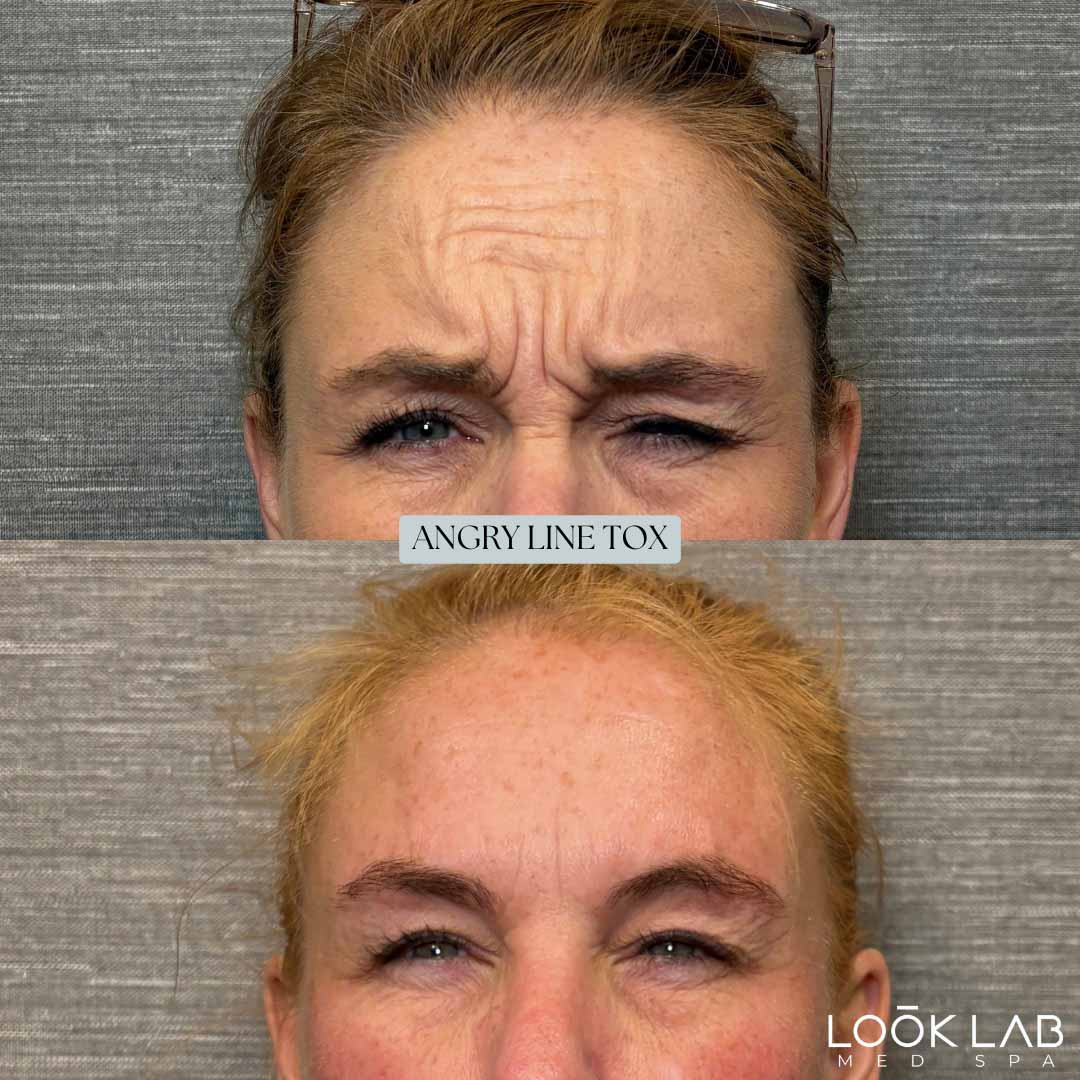 Before and After 25