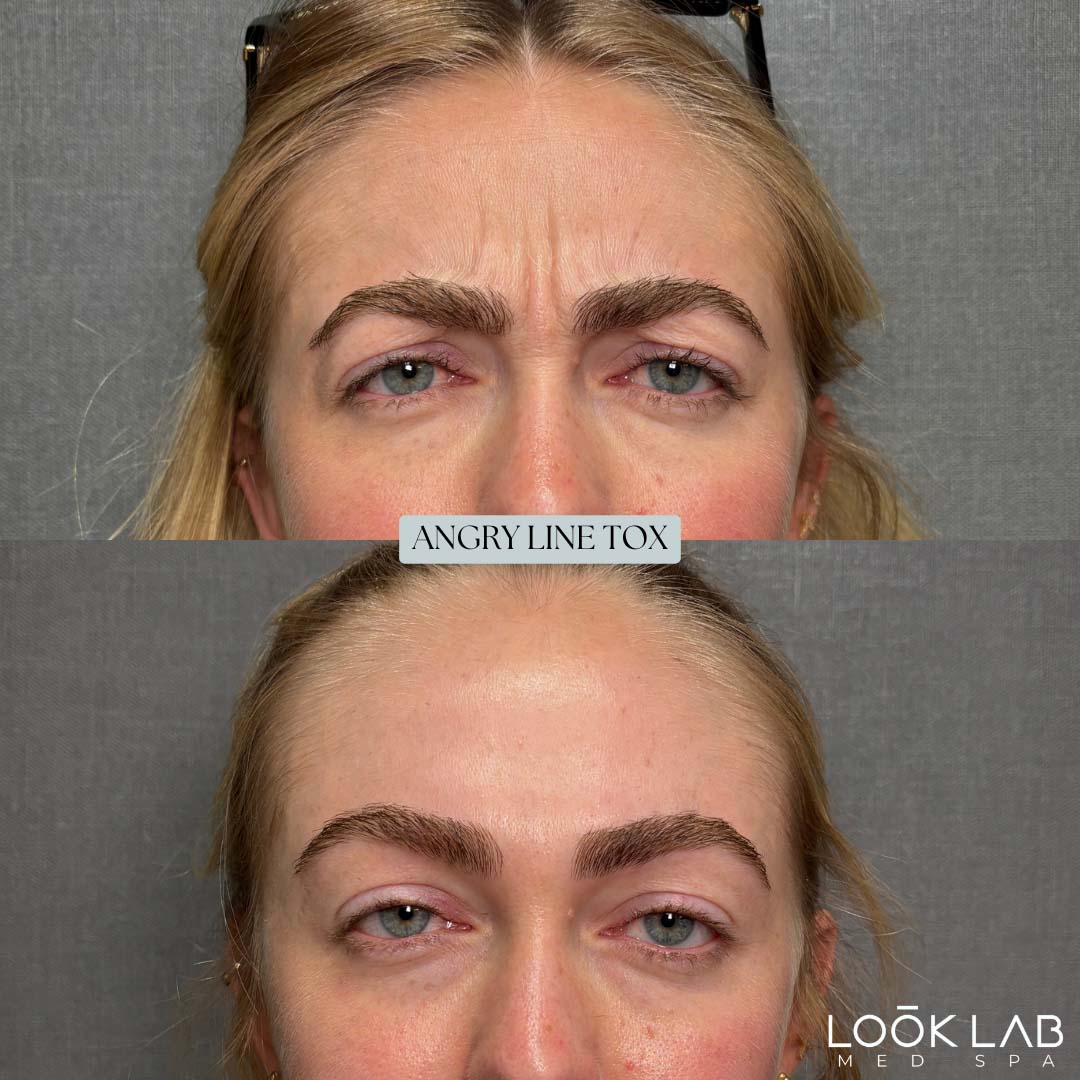 Before and After 26