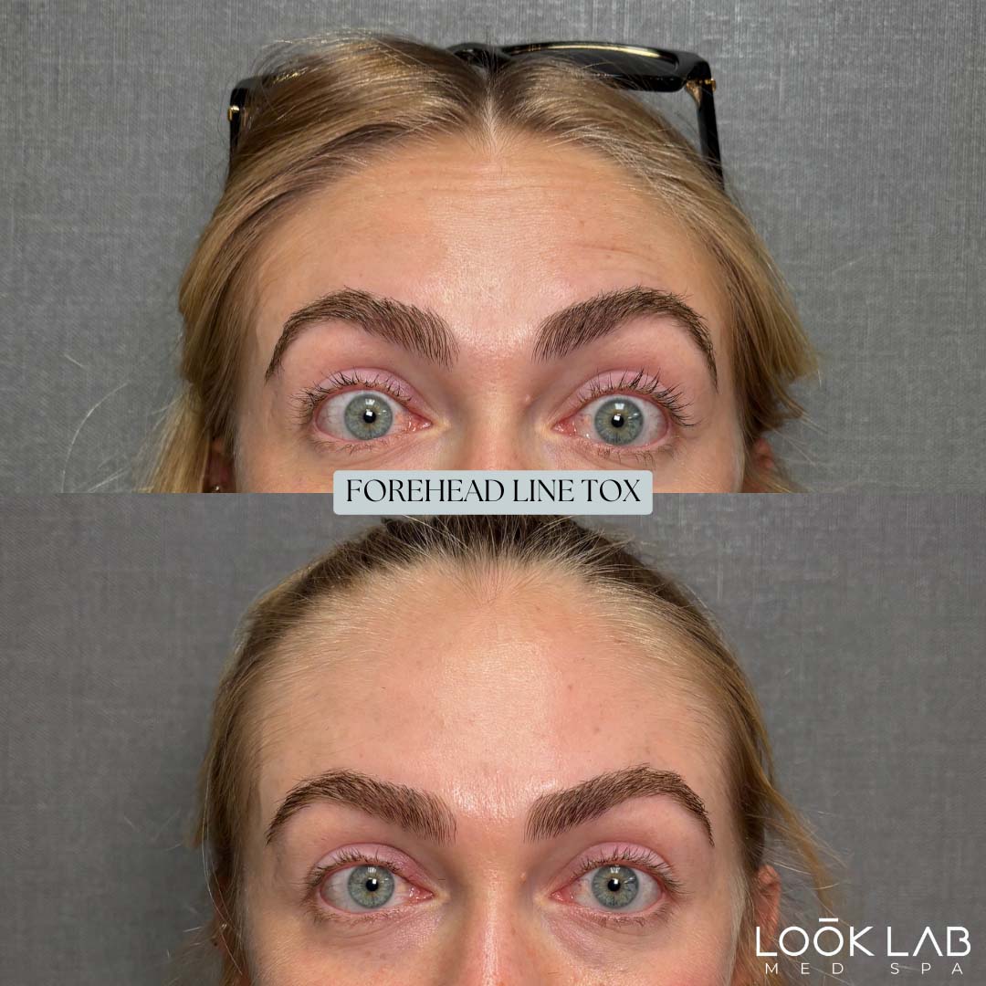 Before and After 27