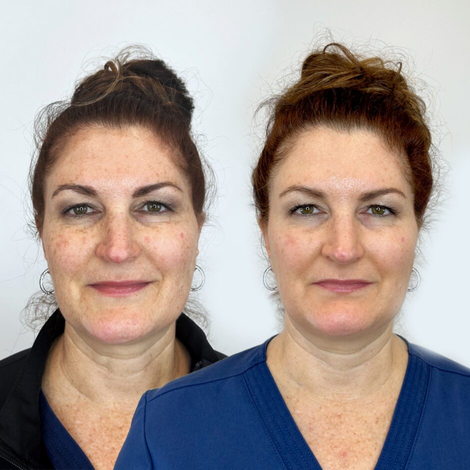 Before and After 1