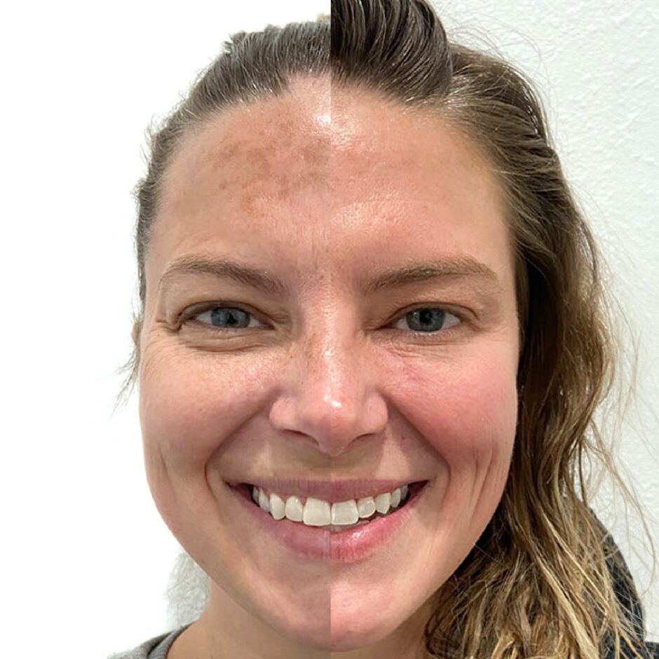 Before and After 4