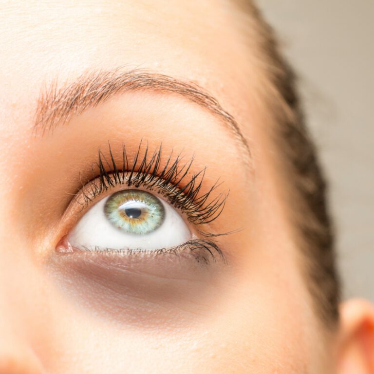 PRF Under Eyes Treatment | Look Lab Med Spa