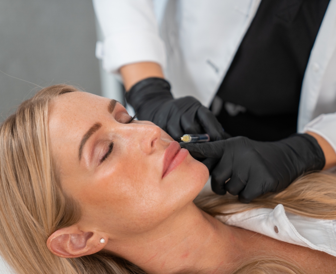 Fillers: Juvederm, Restylane, & Radiesse