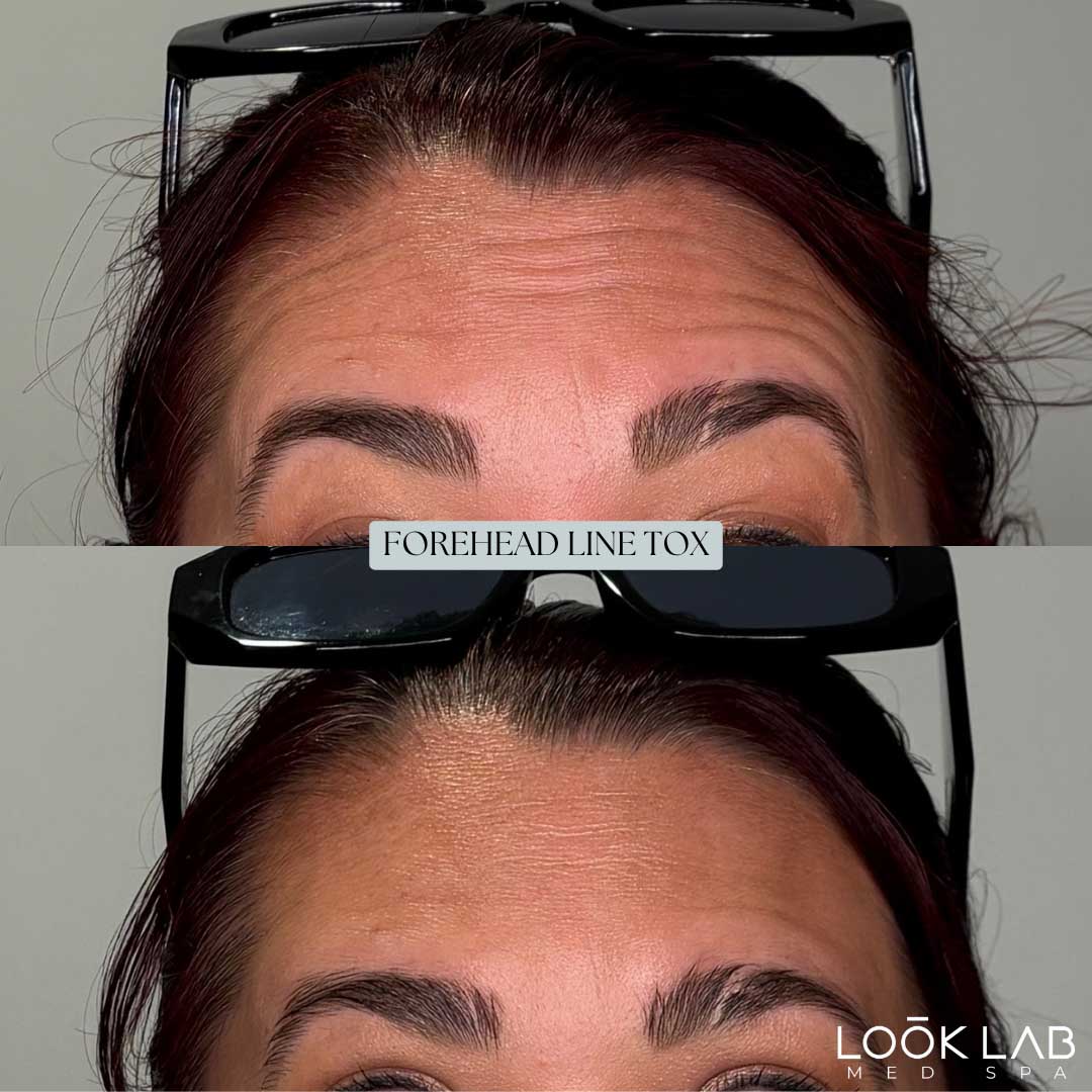 Before and After 22