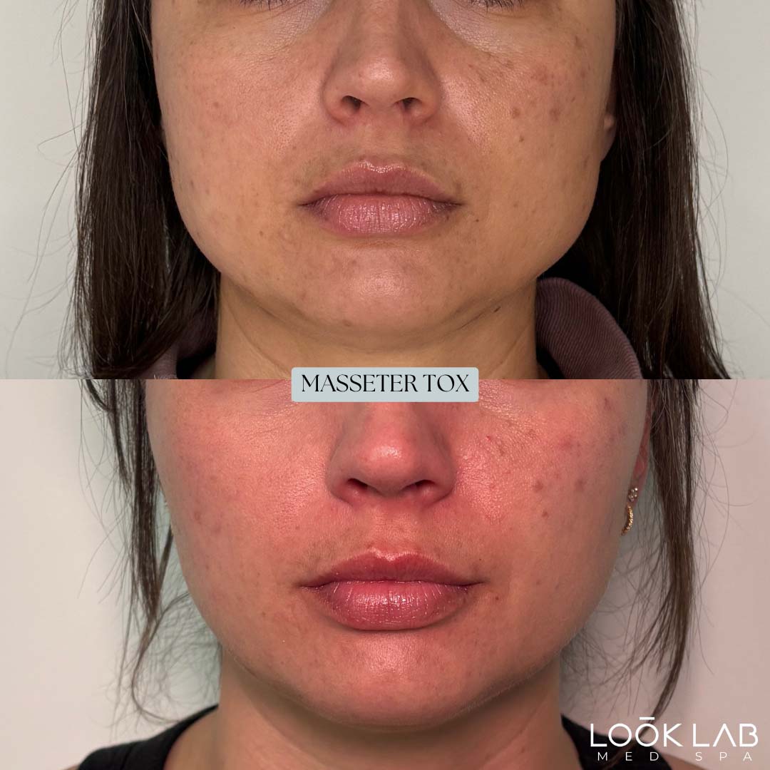Before and After 23