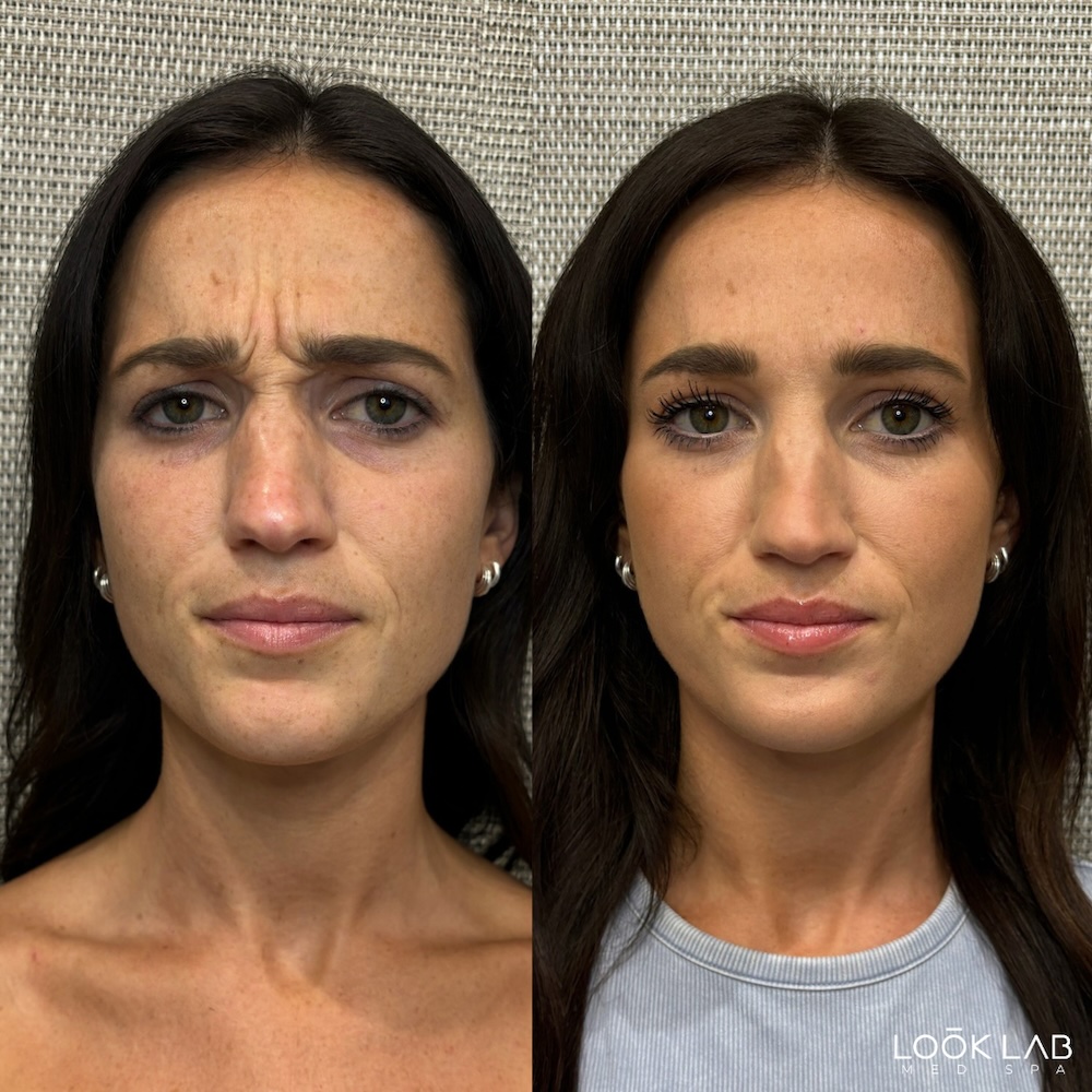 Before and After 5