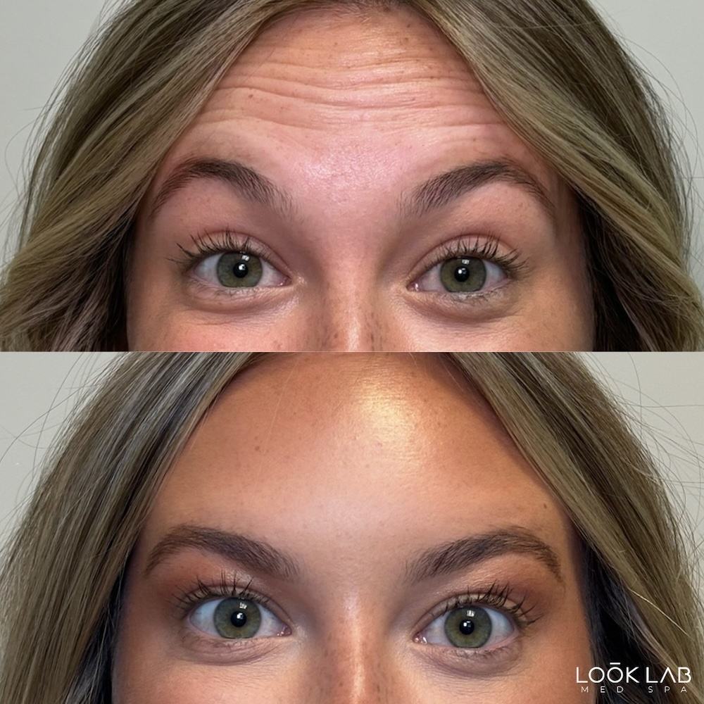 Before and After 6