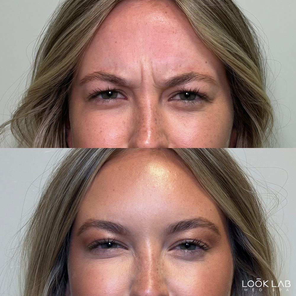 Before and After 7