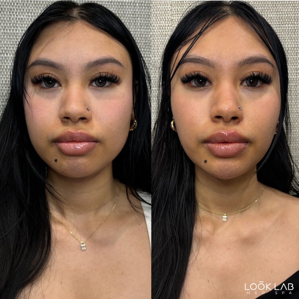 Before and After 9