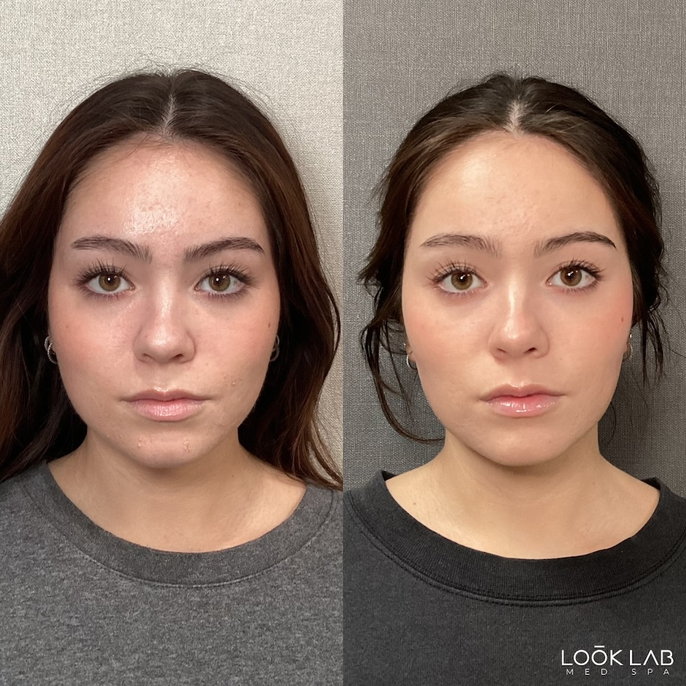 Before and After 10