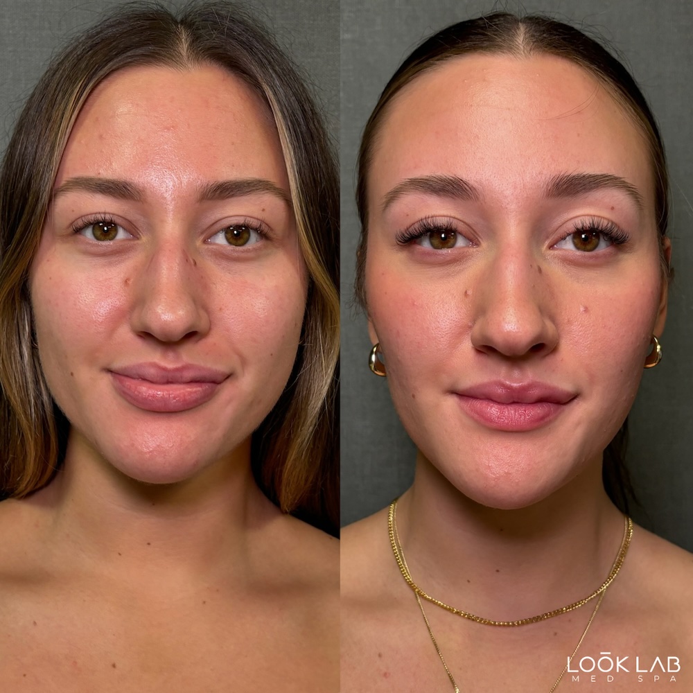 Before and After 11