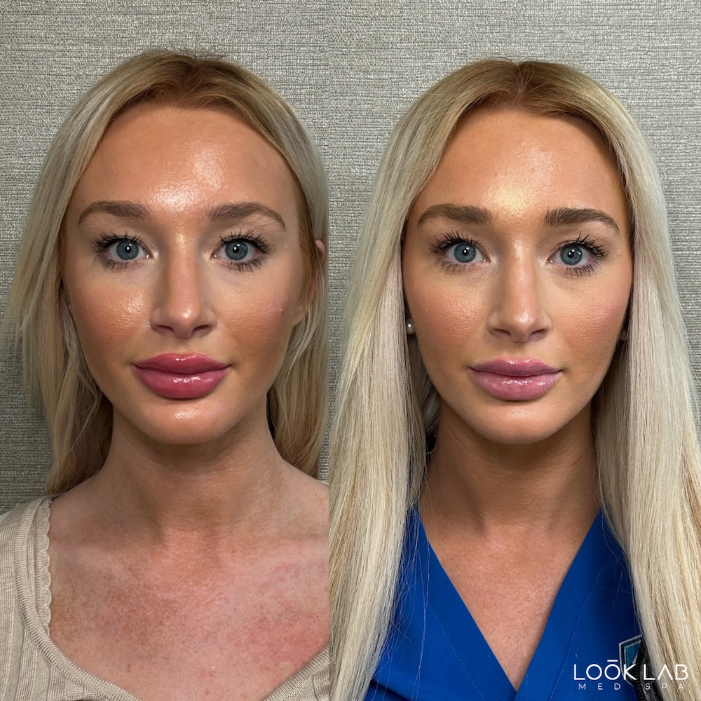 Before and After 12