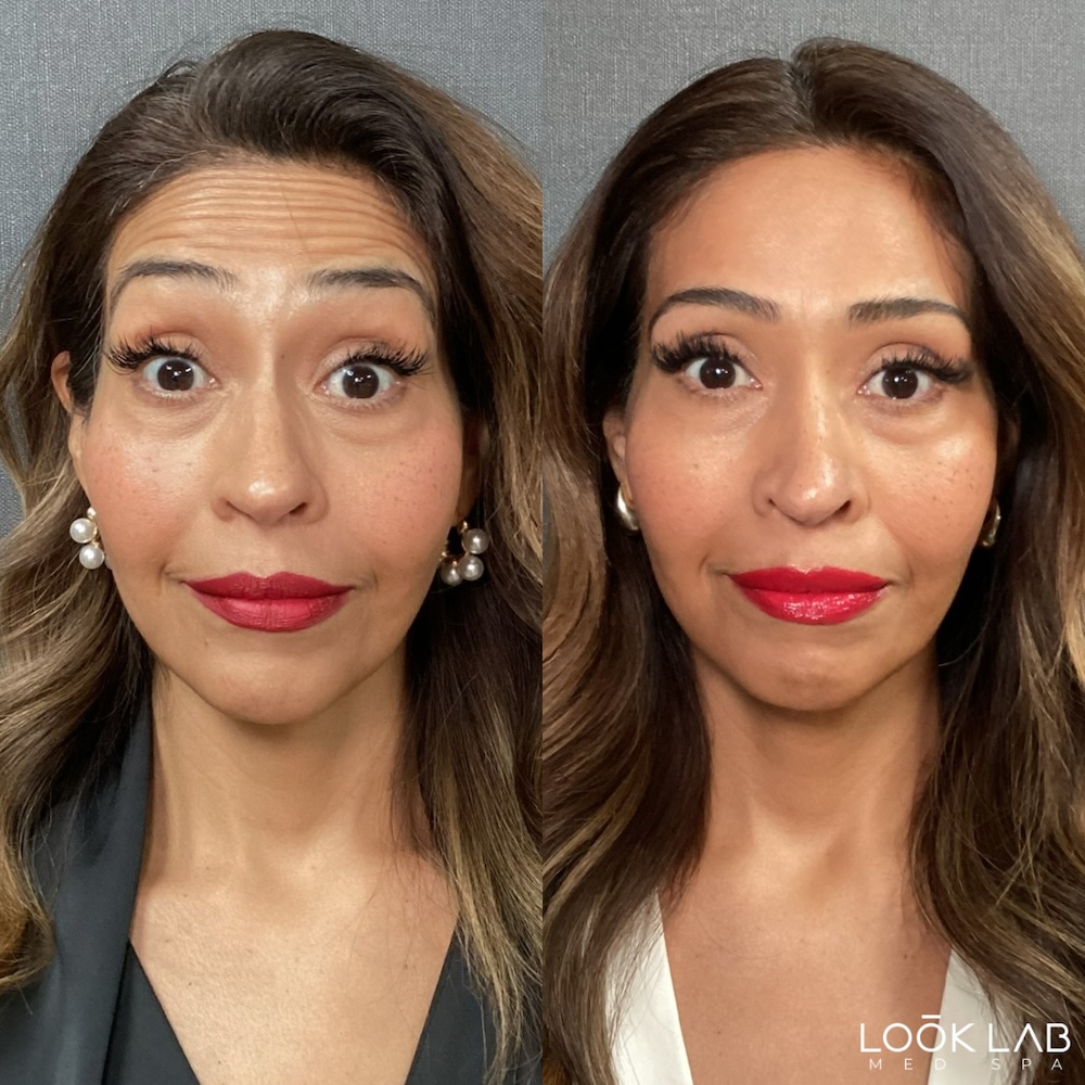 Before and After 16
