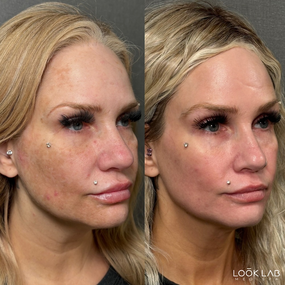 Before and After 6