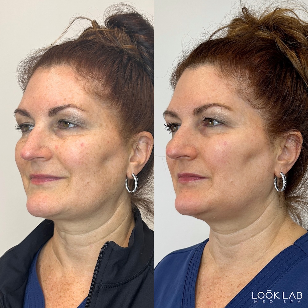 Before and After 8