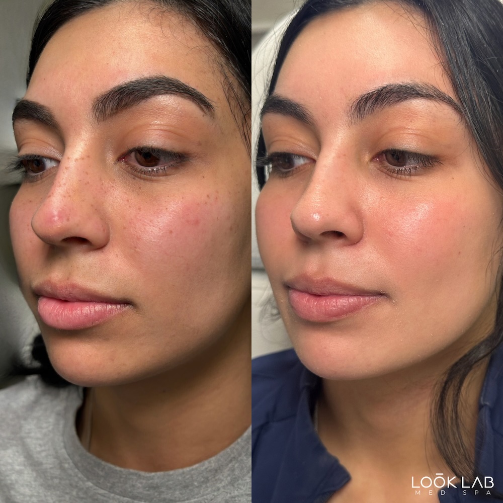 Before and After 7