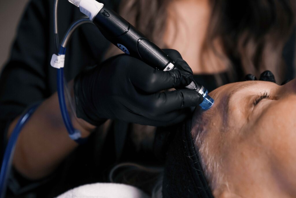 A closeup of a woman's forehead and the Hydrafacial wand at work. When the treatment is done, the woman will enjoy the benefits of a Hydrafacial in Scottsdale.